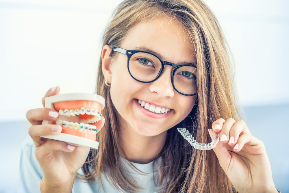 kosten van versnelde orthodontie